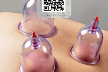 La hijama dans le sport